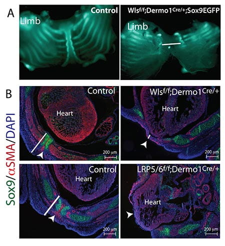 (A) Whole mount images of genetically labeled cartilage show the normal arrangement of ribs and sternum of a developing mouse embryo. Deletion of Wls in developing mesenchyme results in lack of fusion of the sternum (line segment). (B) Images of cross sections at the level of the heart depicting the thoracic body wall are shown (arrowheads). The thickness of the thoracic body wall is reduced after deletion of Wls or Lrp5 and Lrp6 in developing mensenchyme (compare line segments).